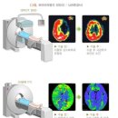 모야모야병[KCD코드 : I67.5]이 희귀질환에 해당하는지 알려주세요! 이미지