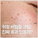 비렌느스팟엑스 내돈내산 전 필독쥐젖 비립종 효과 및크림 부작용 사용법 후기