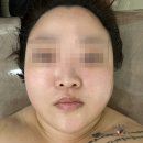 비봉초등학교 | 청주오창에스테틱 '에르벨에스테틱'_뱀부 윤곽관리로 얼굴 라인 정돈 후기