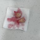 턱편한사랑니치과의원 이미지