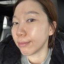 알라딘 | 인천 피부관리 전문 에스테틱 구월동 화이트위치 알라딘필링 후기