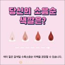 이해와공감 산부인과의원 | 종암동 산부인과 소음순 비대증 수술 후기 많은 곳이 꼭 잘하는 건 아니다.