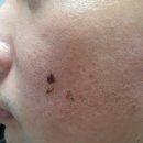 압구정리치모아의원 이미지