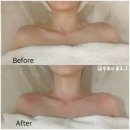 (유)원광메디컬짐 | 빼라리슬리밍센터 강남구청 웨딩관리 드레스라인 관리 추천 후기