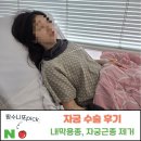 산전검사 중 발견한 내막용종&자궁근종 복강경 수술 후기 (5박6일 입원, 준비물, 주의사항 총정리)