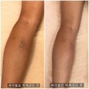 볼라욘씨엘 | [춘천피부관리]리프팅 피부톤 주름개선 웨딩관리윤곽관리 뷰티오로라엘 거두점