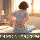 성남 통증의학과 허리 디스크 씨암주사 신경차단술 치료 효과