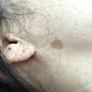 쌍용프라자상가 | 김포 운양동 장기동 기미, 주근깨, 잡티, 흑자제거 피부관리 성지 미작뷰티 김포점