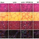 간경화 단백질 발견 이미지