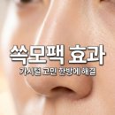 (주)영레이저 | 소극성속모증 탈출 쏙모팩 내돈내산 후기 가성비 피부과 레이저 비교