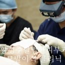 모발자유