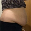 뉴스타의원 | 뉴스타의원 바디온다리프팅, 바디톡스 지방분해주사 내돈내산 후기