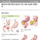 위암 절제수술 문의입니다 이미지