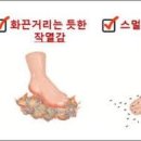 당뇨 합병증 당뇨병성 말초 신경병증 증상 이미지