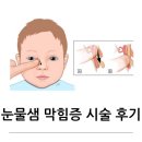 조은안과의원 | 신생아 눈곱 눈꼽 눈물샘폐색 비루관폐색 협착 시술 후기(당감동 누네조은안과/덕천수정안과 방문후기)