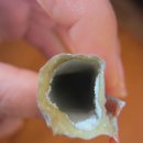 보민한의원 이미지