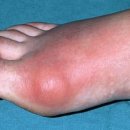 (주)온힐메디컬 이미지