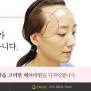 선헤어라인 이미지