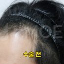 오던모발