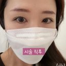 아르떼뷰티샵(ARTE-BEAUTY) | 목동속눈썹 아르떼01 선브로우 블랙물광펌 비포&amp;애프터 후기