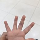 판교퍼스트정형외과의원 네이버블로그