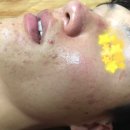 메이렌에스테틱 - 김해시 삼정동 | (모집종료)광주피부관리실에서 페이스관리,여드름관리를 모집합니다 (7명)