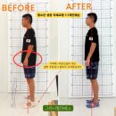 그리니필라테스 | 김포 청소년 자세교정 1:1 그리니필라테스 후기 – 여름방학 집중 레슨으로 걸음·어깨·골반까지 변화