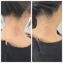 안산두피관리 초기 탈모관리 에스테틱 예뻐졌다 안산고잔점 케어 후기