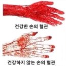 혈관 청소, 산소, 힘, 체온 UP, 혈관 확장 / 액티바이즈 이미지