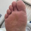 부성초등학교 | 천안두정동 발각질 관리 후기 – 꾸준한 관리로 매끈하게 회복된 발 (풋풋한케어)