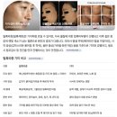 [내돈내산] 2. 엄마 피부를 관리해주자: 피부과 선택