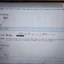 분당 정자역 단기다이어트 빅시다이어트 기기관리 후기