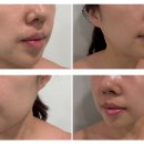 봉선로 | 봉선동 윤곽관리 잘하는곳 광주 남구 피부관리샵