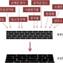 [디톡스 스토리] 14. From 독소 To 장누수증후군 이미지