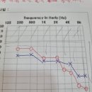 순음보청기의료기 이미지