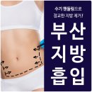 광안카클리닉 | 부산지방흡입후기 제일 먼저 살펴봐야죠
