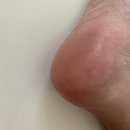 르사(LSA) 이미지