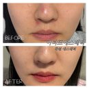 창원 뷰티 ] 이너프에스테틱(4) : 창원 여드름 쏙 들어가게 하는 맞춤 1:1 피부관리 벌써 네번째 솔직후기
