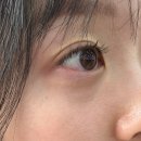 이을안과의원 이미지