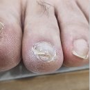 재은네일뷰티 | 영천 청송 내성발톱 아프지않게 관리 잘하는 재은네일뷰티 페디크루 영천점