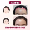 이마 이미지