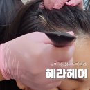 동구미 현대 | 구미 봉곡동 미용실 혜라헤어에서 두피케어 리프팅 받고온 후기
