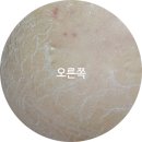 피부1004