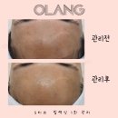 베네핏 에스테틱 이미지