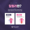 와이미즈산부인과의원 | 관계가 불만족스럽다면 이것 때문일 수도 있습니다! 범계질필러로 해결해요