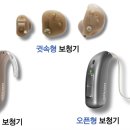 동성 보조기 이미지