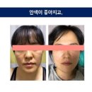 SNPE를 통한 몸과 마음의 변화_90기 사유라 이미지