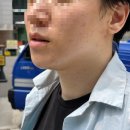 번화1로84번길R | 미사에스테틱 미사피부관리 임쁨 여드름 색소침착 관리 후기