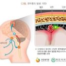 오른쪽관자놀이통증 왼쪽관자놀이통증 관자놀이두통 관자놀이통증! 이미지