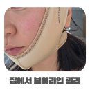 하이메디텍 | 리프팅밴드 얼굴리프팅밴드 아트메디텍 브이라인밴드 사용 후기